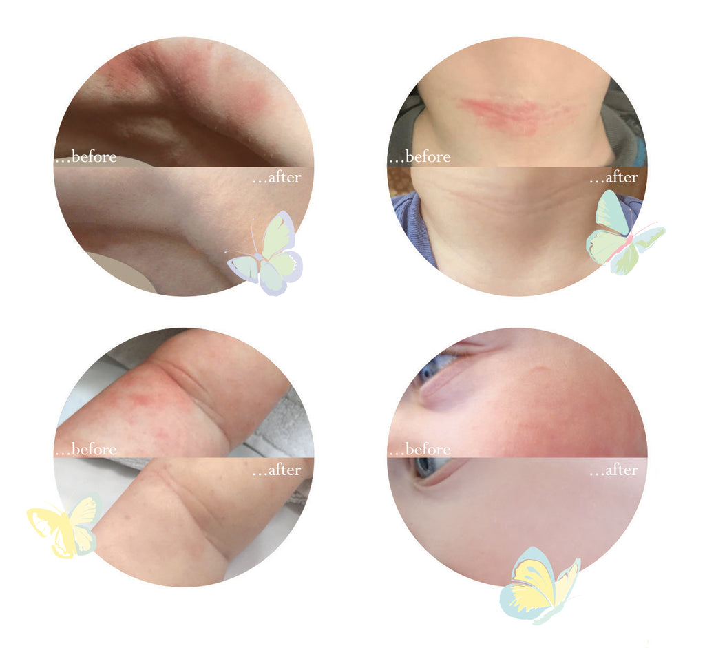 Before and After Images with Butterflies