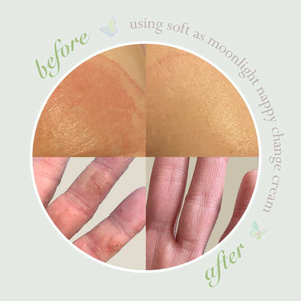 Before-and-After Skincare Comparison