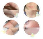 Before and After Images with Butterflies