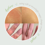 Before-and-After Skincare Comparison