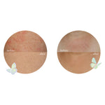 Changes in skin quality